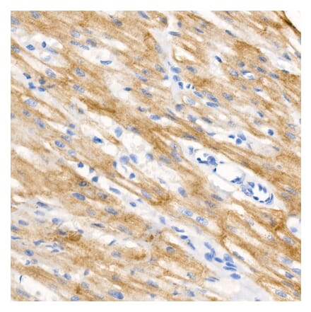Immunohistochemistry - Anti-Cardiac Troponin I (phospho Ser23 + Ser24) Antibody [ARC56024] (A308541) - Antibodies.com