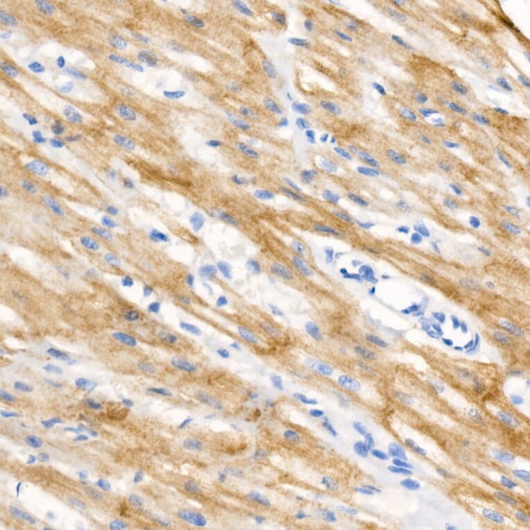 Immunohistochemistry - Anti-Cardiac Troponin I (phospho Ser23 + Ser24) Antibody [ARC56024] (A308541) - Antibodies.com