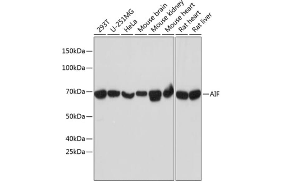 Western Blot - Anti-AIF Antibody [ARC0015] (A308543) - Antibodies.com