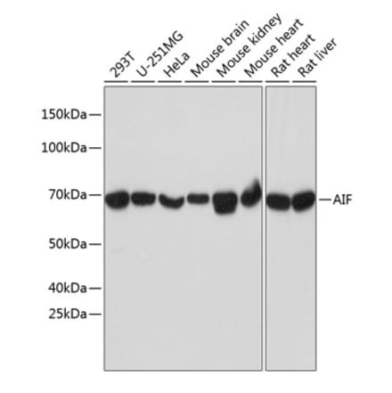 Western Blot - Anti-AIF Antibody [ARC0015] (A308543) - Antibodies.com