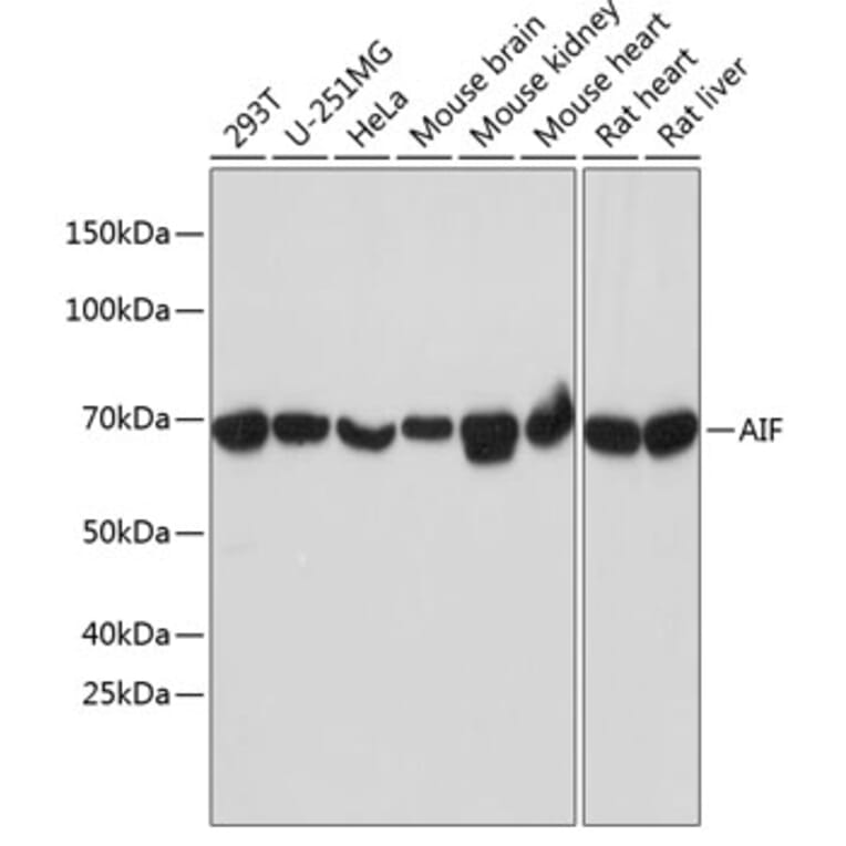 Western Blot - Anti-AIF Antibody [ARC0015] (A308543) - Antibodies.com