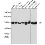 Western Blot - Anti-AIF Antibody [ARC0015] (A308543) - Antibodies.com