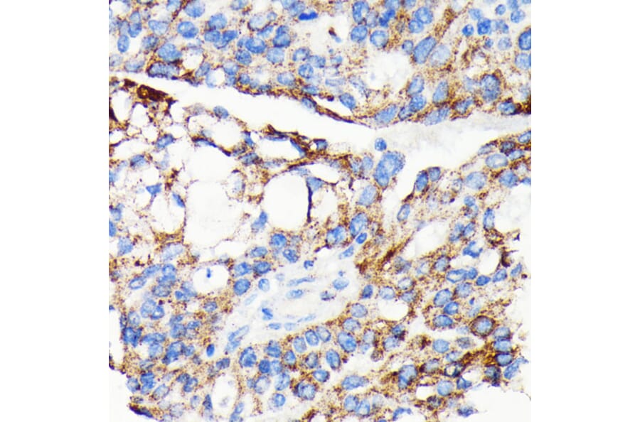 Immunohistochemistry - Anti-AIF Antibody [ARC0015] (A308543) - Antibodies.com