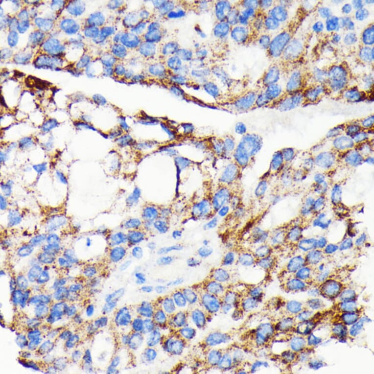 Immunohistochemistry - Anti-AIF Antibody [ARC0015] (A308543) - Antibodies.com