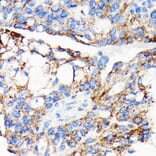 Immunohistochemistry - Anti-AIF Antibody [ARC0015] (A308543) - Antibodies.com