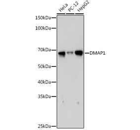 Western Blot - Anti-DMAP1 Antibody [ARC2462] (A308546) - Antibodies.com