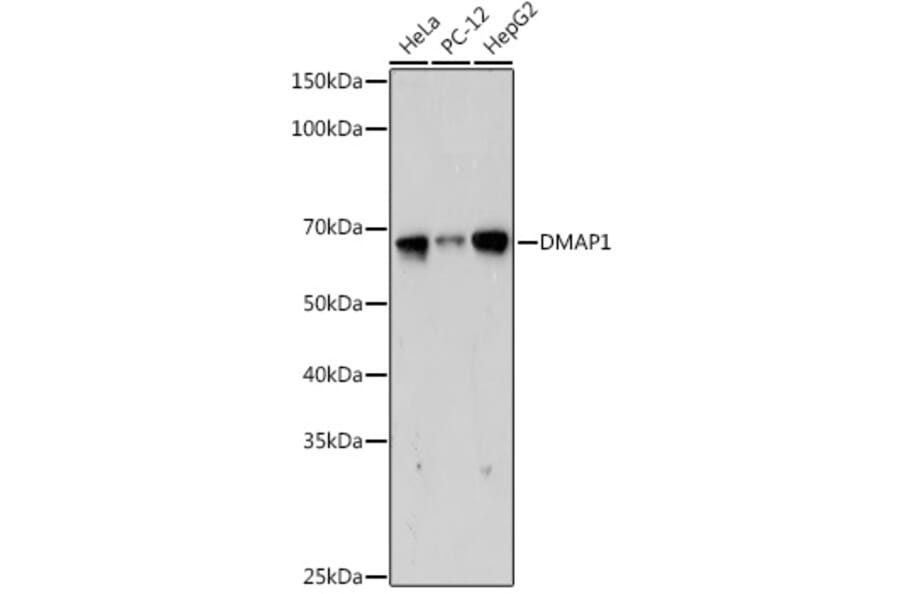 Western Blot - Anti-DMAP1 Antibody [ARC2462] (A308546) - Antibodies.com