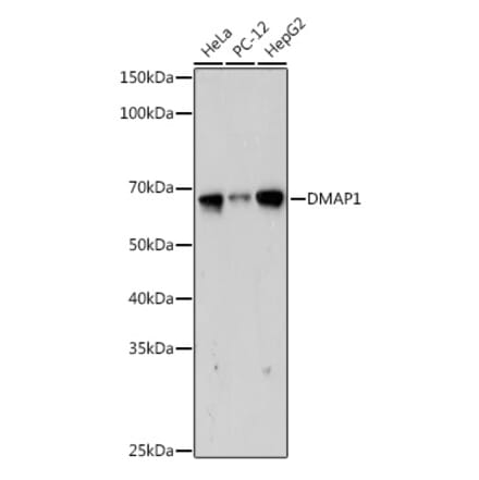 Western Blot - Anti-DMAP1 Antibody [ARC2462] (A308546) - Antibodies.com