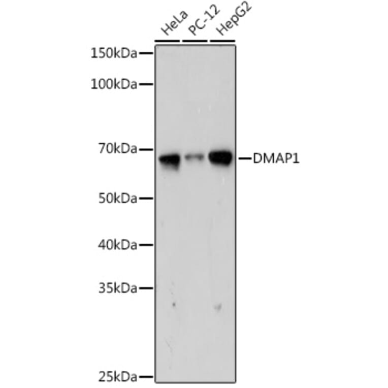 Western Blot - Anti-DMAP1 Antibody [ARC2462] (A308546) - Antibodies.com