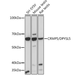 Western Blot - Anti-CRMP5 Antibody [ARC2020] (A308547) - Antibodies.com