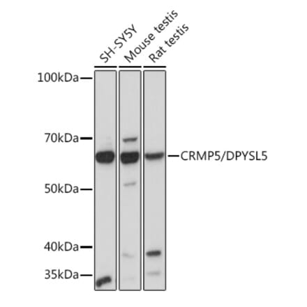 Western Blot - Anti-CRMP5 Antibody [ARC2020] (A308547) - Antibodies.com