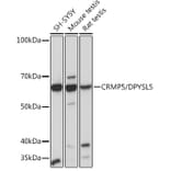 Western Blot - Anti-CRMP5 Antibody [ARC2020] (A308547) - Antibodies.com