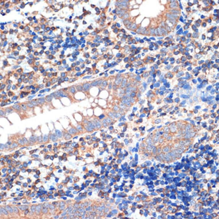Immunohistochemistry - Anti-CRMP5 Antibody [ARC2020] (A308547) - Antibodies.com