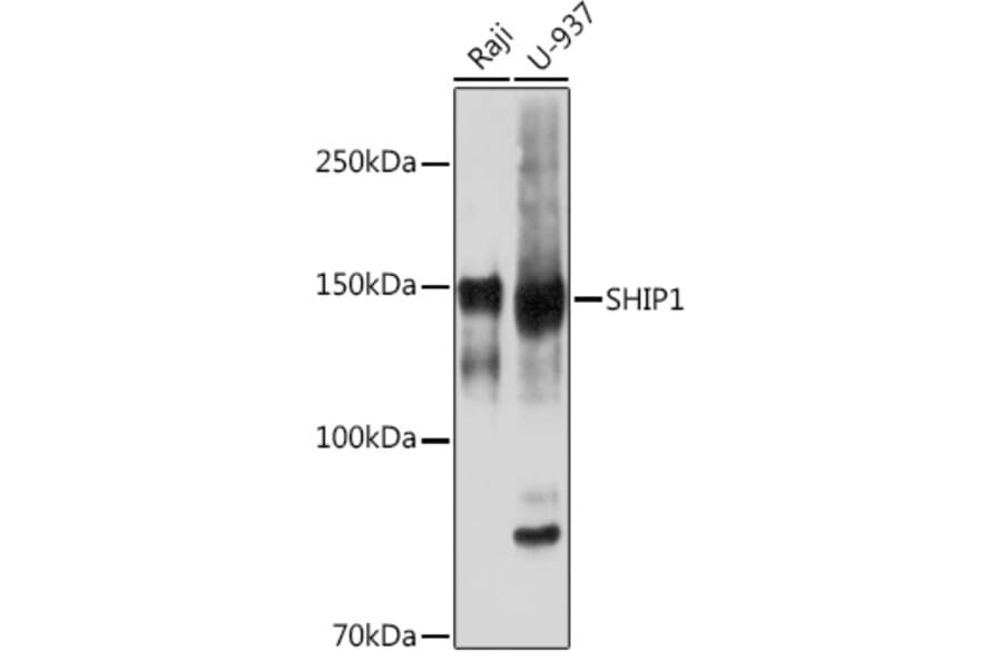 Western Blot - Anti-SHIP-1 Antibody [ARC2047] (A308548) - Antibodies.com