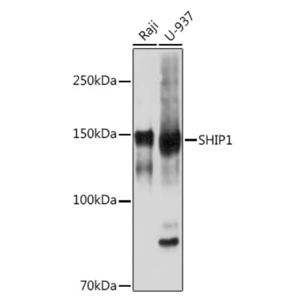 Western Blot - Anti-SHIP-1 Antibody [ARC2047] (A308548) - Antibodies.com