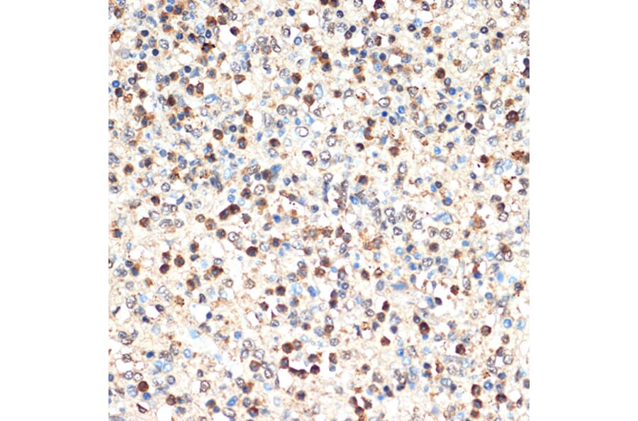 Immunohistochemistry - Anti-SHIP-1 Antibody [ARC2047] (A308548) - Antibodies.com