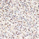 Immunohistochemistry - Anti-SHIP-1 Antibody [ARC2047] (A308548) - Antibodies.com