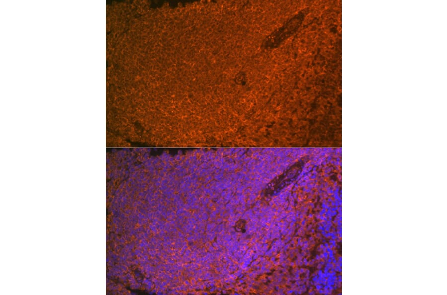 Immunofluorescence - Anti-SHIP-1 Antibody [ARC2047] (A308548) - Antibodies.com