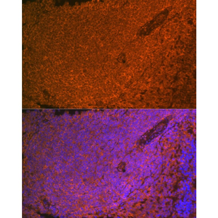 Immunofluorescence - Anti-SHIP-1 Antibody [ARC2047] (A308548) - Antibodies.com