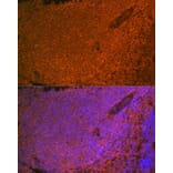 Immunofluorescence - Anti-SHIP-1 Antibody [ARC2047] (A308548) - Antibodies.com