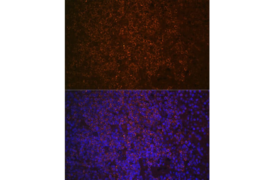 Immunofluorescence - Anti-SHIP-1 Antibody [ARC2047] (A308548) - Antibodies.com