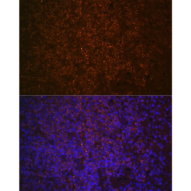 Immunofluorescence - Anti-SHIP-1 Antibody [ARC2047] (A308548) - Antibodies.com