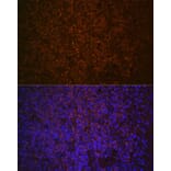 Immunofluorescence - Anti-SHIP-1 Antibody [ARC2047] (A308548) - Antibodies.com
