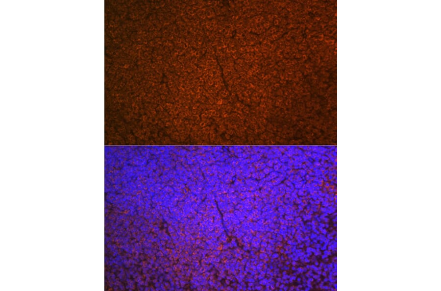 Immunofluorescence - Anti-SHIP-1 Antibody [ARC2047] (A308548) - Antibodies.com