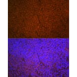 Immunofluorescence - Anti-SHIP-1 Antibody [ARC2047] (A308548) - Antibodies.com