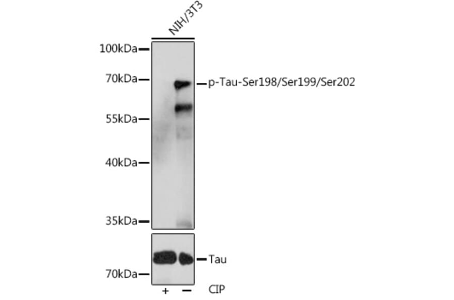 Western Blot - Anti-Tau (phospho Ser246 + Ser259 + Ser220) Antibody (A308549) - Antibodies.com