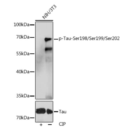 Western Blot - Anti-Tau (phospho Ser246 + Ser259 + Ser220) Antibody (A308549) - Antibodies.com