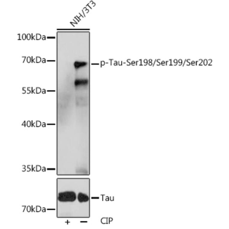 Western Blot - Anti-Tau (phospho Ser246 + Ser259 + Ser220) Antibody (A308549) - Antibodies.com