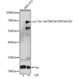 Western Blot - Anti-Tau (phospho Ser246 + Ser259 + Ser220) Antibody (A308549) - Antibodies.com