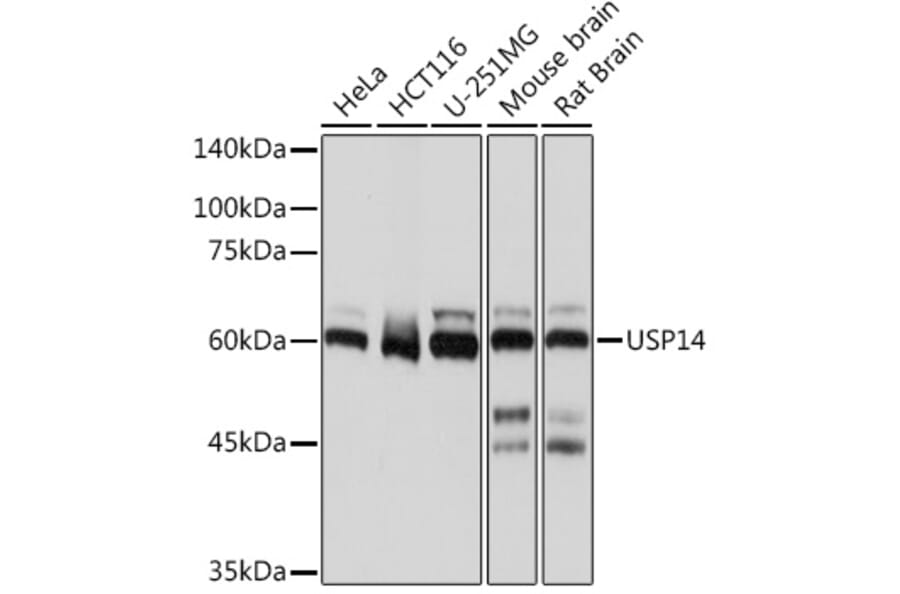 Western Blot - Anti-USP14/TGT Antibody [ARC2185] (A308550) - Antibodies.com