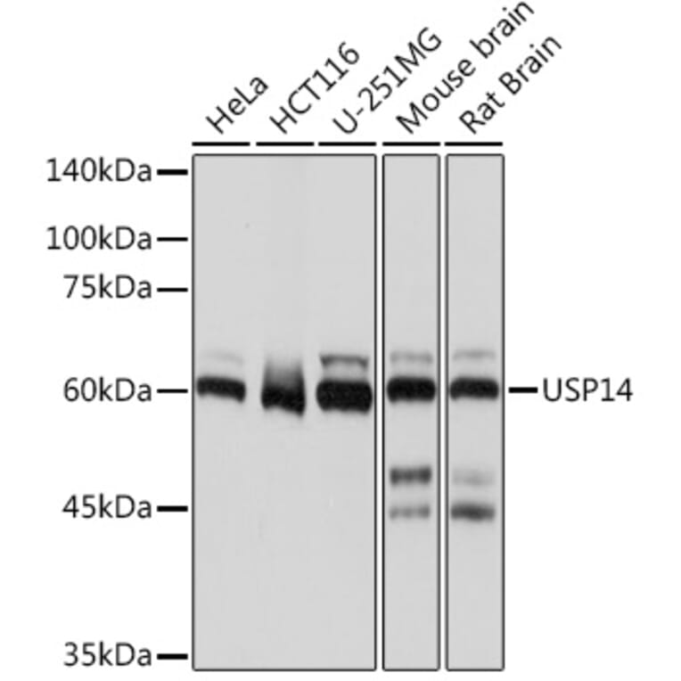 Western Blot - Anti-USP14/TGT Antibody [ARC2185] (A308550) - Antibodies.com