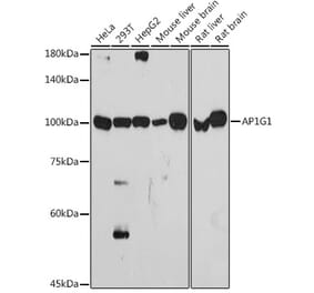 Western Blot - Anti-gamma Adaptin Antibody [ARC2440] (A308552) - Antibodies.com