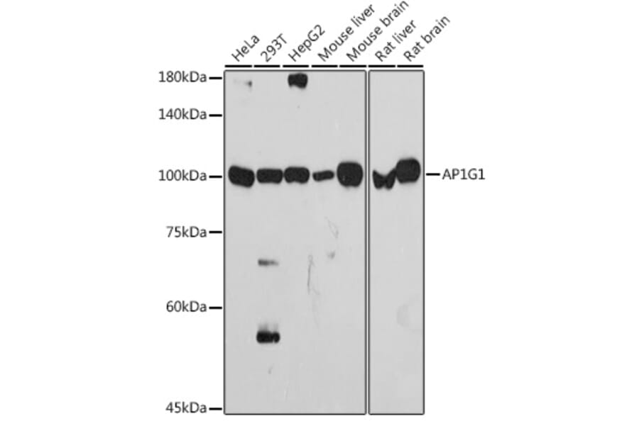 Western Blot - Anti-gamma Adaptin Antibody [ARC2440] (A308552) - Antibodies.com