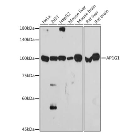 Western Blot - Anti-gamma Adaptin Antibody [ARC2440] (A308552) - Antibodies.com