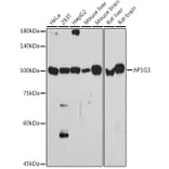 Western Blot - Anti-gamma Adaptin Antibody [ARC2440] (A308552) - Antibodies.com