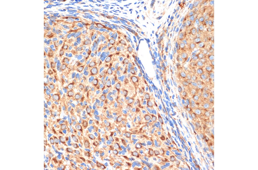 Immunohistochemistry - Anti-gamma Adaptin Antibody [ARC2440] (A308552) - Antibodies.com