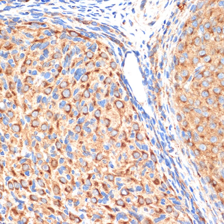 Immunohistochemistry - Anti-gamma Adaptin Antibody [ARC2440] (A308552) - Antibodies.com