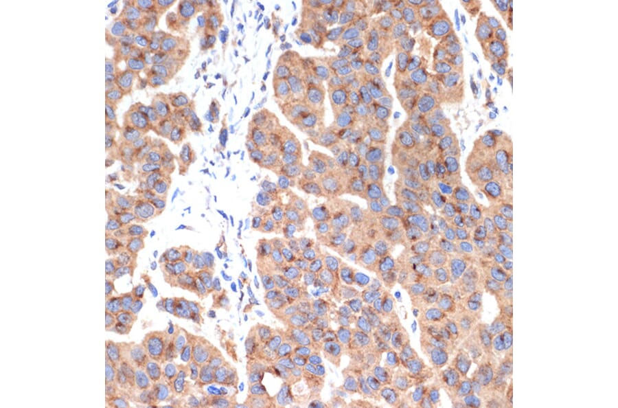 Immunohistochemistry - Anti-gamma Adaptin Antibody [ARC2440] (A308552) - Antibodies.com