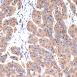 Immunohistochemistry - Anti-gamma Adaptin Antibody [ARC2440] (A308552) - Antibodies.com