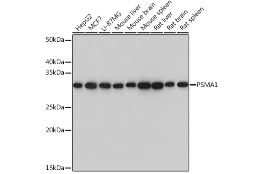 Western Blot - Anti-Proteasome 20S C2/HC2 Antibody [ARC0780] (A308553) - Antibodies.com