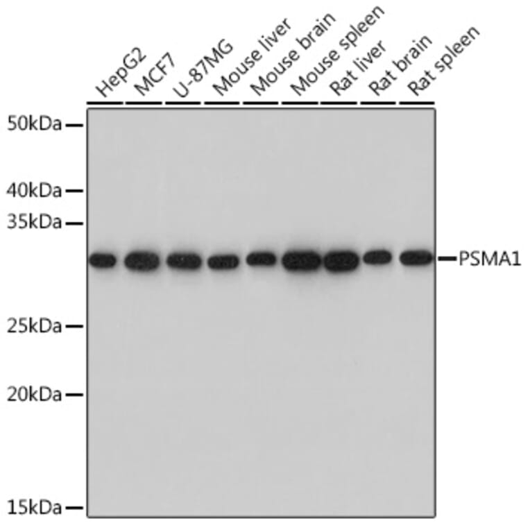 Western Blot - Anti-Proteasome 20S C2/HC2 Antibody [ARC0780] (A308553) - Antibodies.com