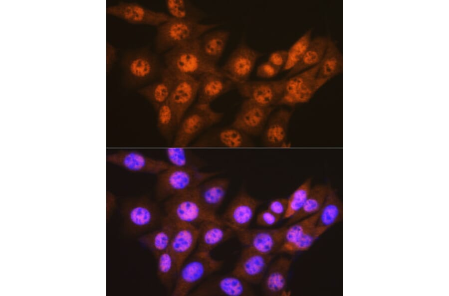Immunofluorescence - Anti-Proteasome 20S C2/HC2 Antibody [ARC0780] (A308553) - Antibodies.com