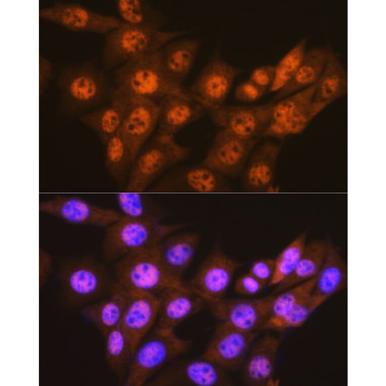 Immunofluorescence - Anti-Proteasome 20S C2/HC2 Antibody [ARC0780] (A308553) - Antibodies.com