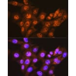Immunofluorescence - Anti-Proteasome 20S C2/HC2 Antibody [ARC0780] (A308553) - Antibodies.com