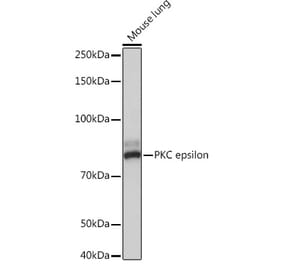 Western Blot - Anti-PKC epsilon Antibody [ARC1270] (A308554) - Antibodies.com