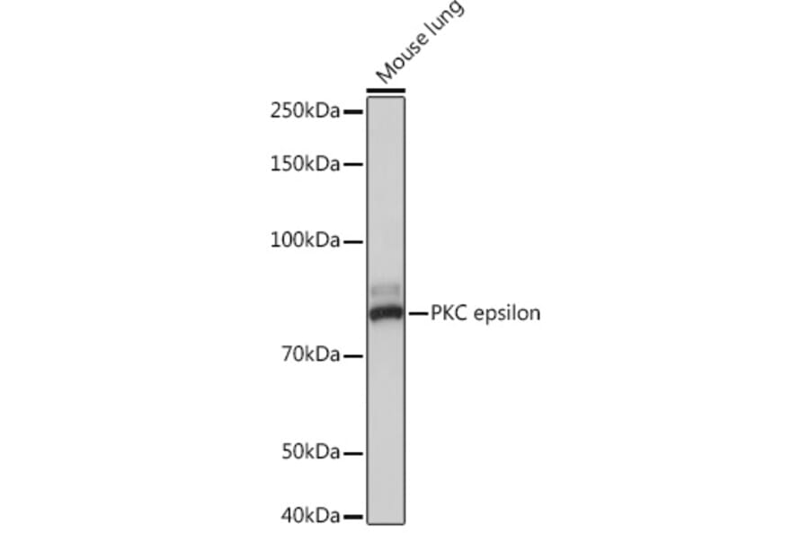 Western Blot - Anti-PKC epsilon Antibody [ARC1270] (A308554) - Antibodies.com